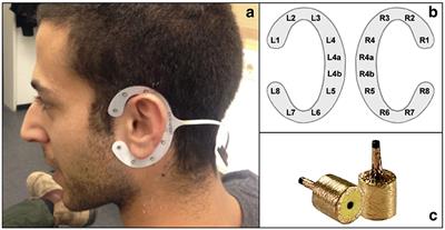 Assessing focus through ear-EEG: a comparative study between conventional cap EEG and mobile in- and around-the-ear EEG systems